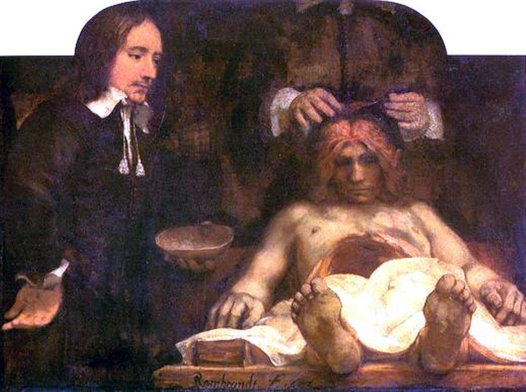 Rembrandt Van Rijn Anatomy of Doctor Deyman - Canvas Print